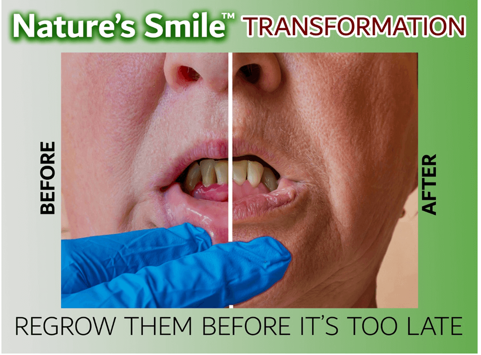 Nature's Smile™ - A Simple Solution