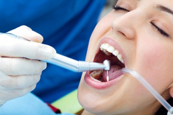 Preventing Receding Gums: The Importance Of Dental Checkups